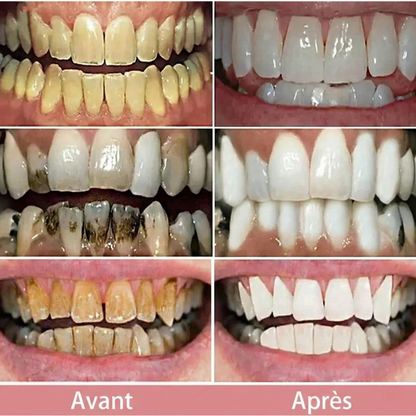Sérum Correcteur Blanchissant V34 - 30 ml